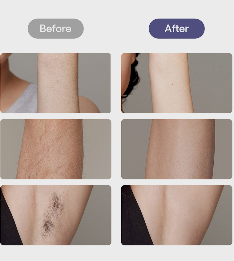 Air 10 IPL Hair Removal Device with Leather Case