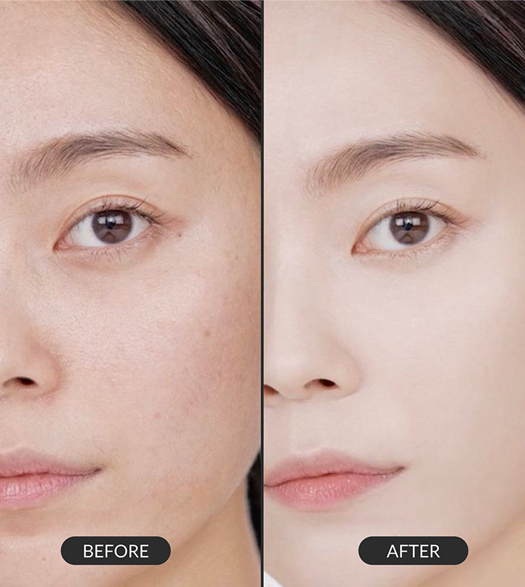IPSE Korean Premium Botonix Ampoule Face & Neck Serum 60ml - Skin Care Anti Aging Facial Brightening Serum - Reduce Fine Line, Wrinkle with 24k Gold