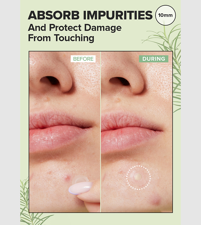 Timeout Blemish Mask Patch, 10mm