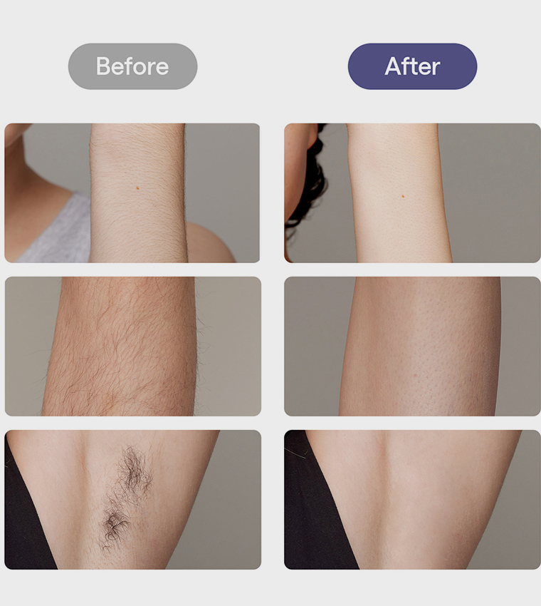 Air 10 IPL Hair Removal Device