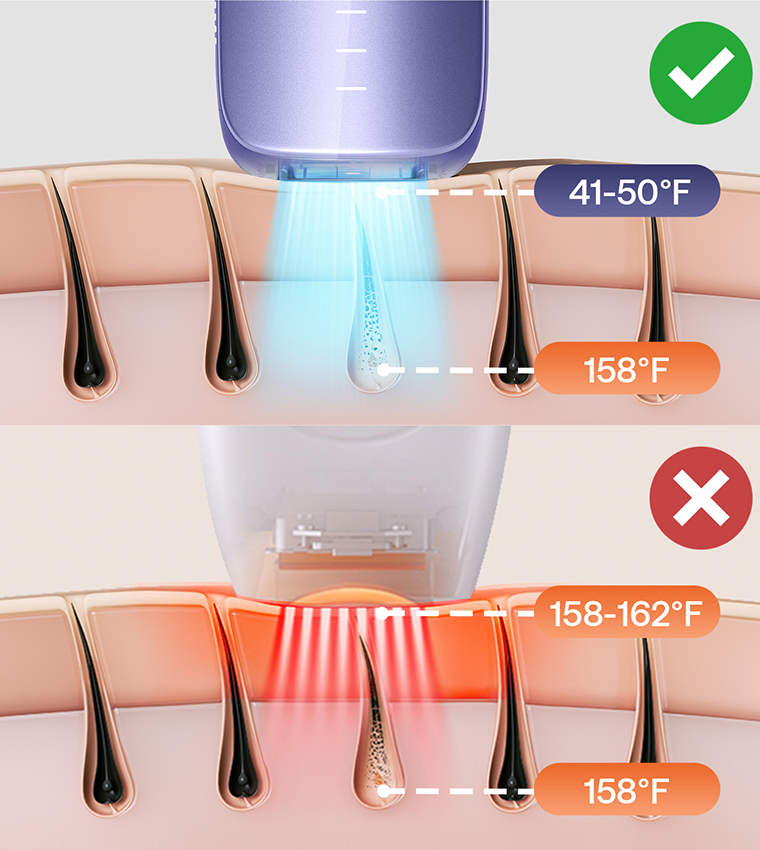 Air 3 IPL Hair Removal Device with Leather Case