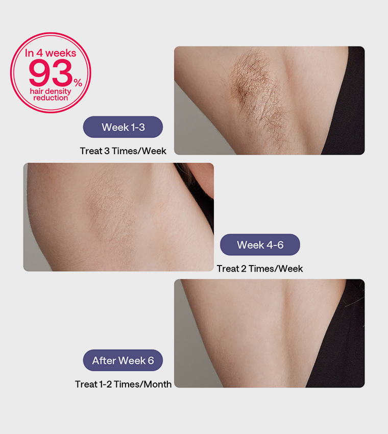 Air 3 IPL Hair Removal Device with Leather Case