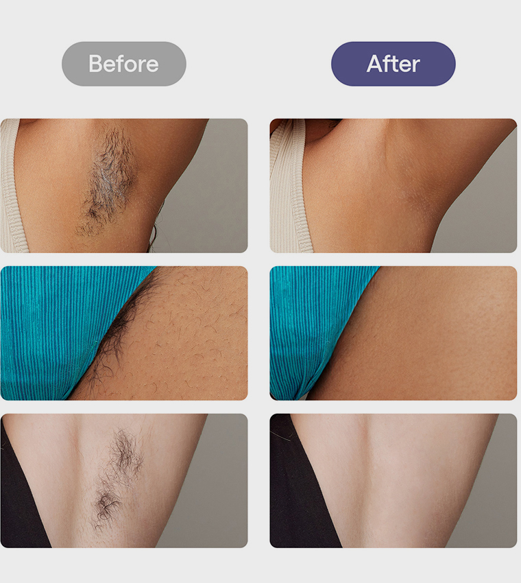 Air 3 IPL Hair Removal Device with Leather Case