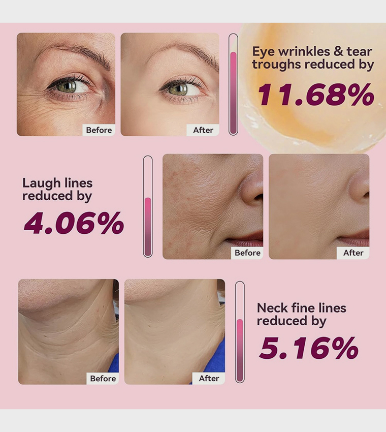 Cemenrete Calcium Multi Balm, 9g