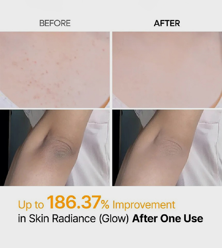 Peel Shot Exfoliating Kojic Acid Turmeric Spray, 200ml