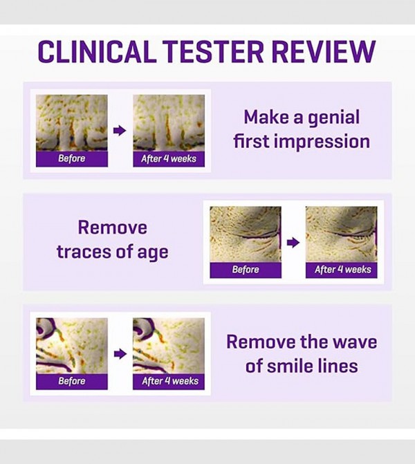 SOME BY MI  - Multi Eye Care