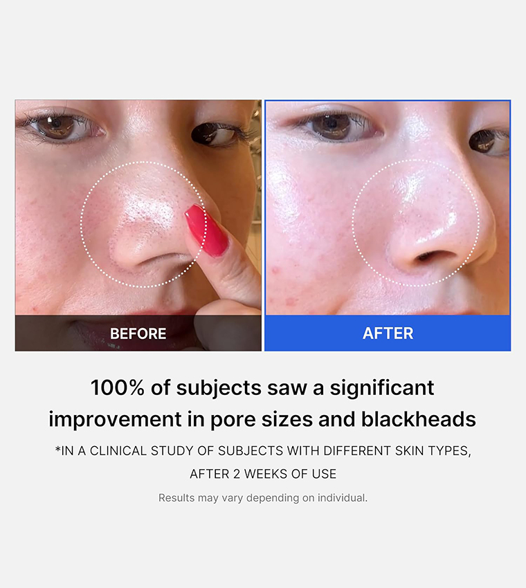 Zero Pore Pad 2.0, 150g